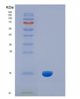 Recombinant Human IL5 Protein,Recombinant Human IL5 Protein