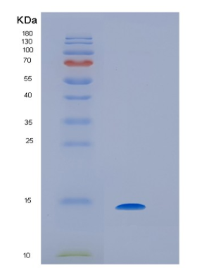 Recombinant Human IL9 Protein,Recombinant Human IL9 Protein