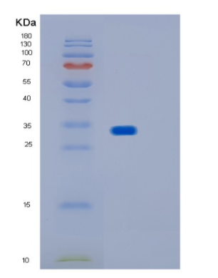 Recombinant Human IMPA1 Protein,Recombinant Human IMPA1 Protein