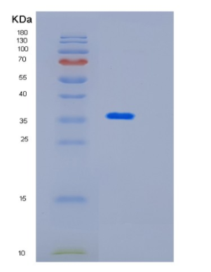 Recombinant Mouse Impad1 Protein,Recombinant Mouse Impad1 Protein