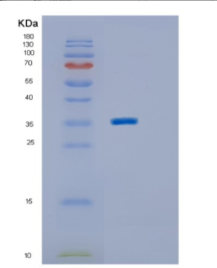 Recombinant Human ING2 Protein,Recombinant Human ING2 Protein