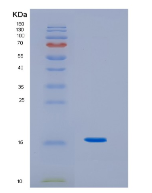 Recombinant Human IL3 Protein,Recombinant Human IL3 Protein