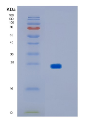 Recombinant Human IMP3 Protein,Recombinant Human IMP3 Protein