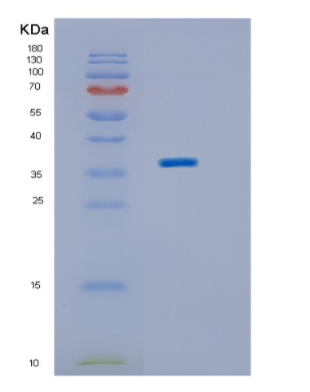 Recombinant Human IMPAD1 Protein,Recombinant Human IMPAD1 Protein