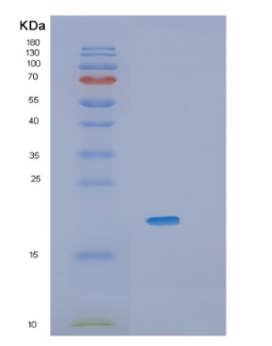 Recombinant Mouse Il36a Protein,Recombinant Mouse Il36a Protein