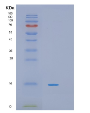 Recombinant Mouse IL4 Protein,Recombinant Mouse IL4 Protein