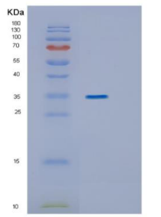 Recombinant Human ING1 Protein,Recombinant Human ING1 Protein