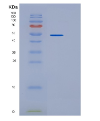 Recombinant Mouse Intercellular adhesion molecule 1 Protein,Recombinant Mouse Intercellular adhesion molecule 1 Protein