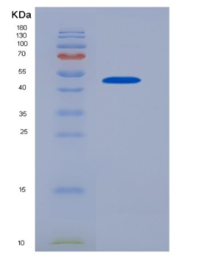 Recombinant Mouse Interferon-β 1 Protein,Recombinant Mouse Interferon-β 1 Protein