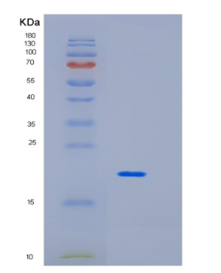 Recombinant Human Interleukin-10 Protein,Recombinant Human Interleukin-10 Protein