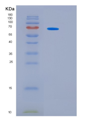 Recombinant Mouse Interleukin-6 receptor subunit beta Protein,Recombinant Mouse Interleukin-6 receptor subunit beta Protein