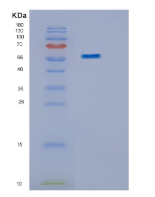 Recombinant Human IMPDH1 Protein,Recombinant Human IMPDH1 Protein