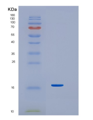 Recombinant Human Interferon-g Protein,Recombinant Human Interferon-g Protein