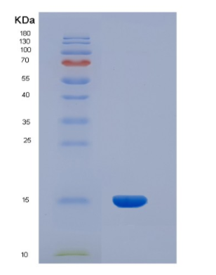 Recombinant Human INHBA Protein,Recombinant Human INHBA Protein