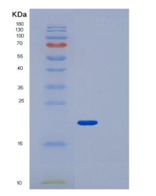 Recombinant Human IPP-1 Protein,Recombinant Human IPP-1 Protein