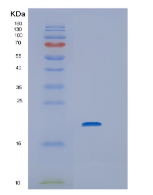 Recombinant Human Interleukin 6 Protein,Recombinant Human Interleukin 6 Protein