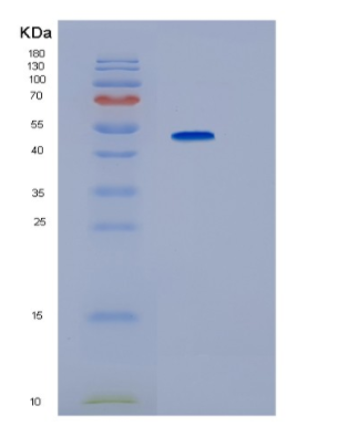 Recombinant Human IP6K2 Protein,Recombinant Human IP6K2 Protein