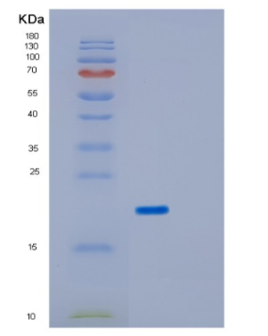 Recombinant Human IRGM Protein,Recombinant Human IRGM Protein