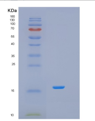 Recombinant Human ISOC2 Protein,Recombinant Human ISOC2 Protein