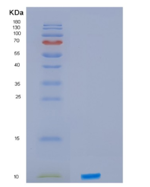 Recombinant Human IRF5 Protein,Recombinant Human IRF5 Protein