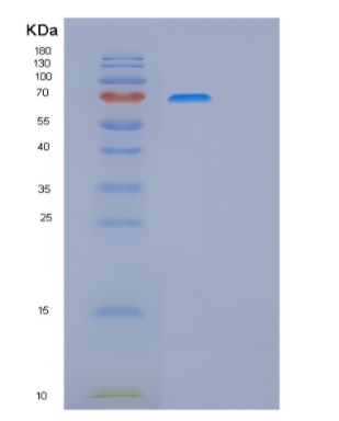 Recombinant Human ITGB1 Protein,Recombinant Human ITGB1 Protein