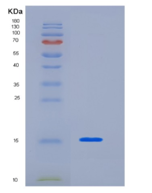 Recombinant Human KHDC1L Protein,Recombinant Human KHDC1L Protein