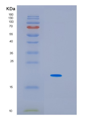 Recombinant Human Interleukin-6 Protein,Recombinant Human Interleukin-6 Protein