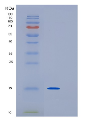 Recombinant Human IRF1 Protein,Recombinant Human IRF1 Protein