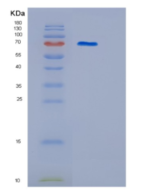 Recombinant Human ITGB2 Protein,Recombinant Human ITGB2 Protein