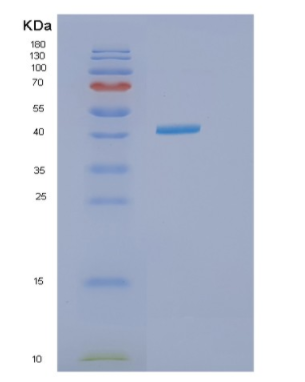 Recombinant Human IVD Protein,Recombinant Human IVD Protein