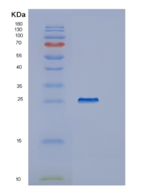 Recombinant Human IYD Protein,Recombinant Human IYD Protein