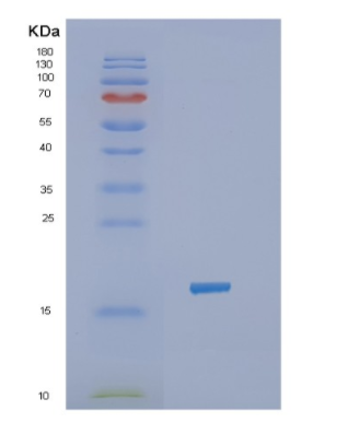 Recombinant Human JAK2 Protein,Recombinant Human JAK2 Protein