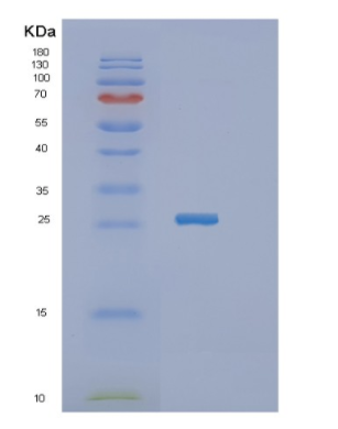 Recombinant Human JAM2 Protein,Recombinant Human JAM2 Protein