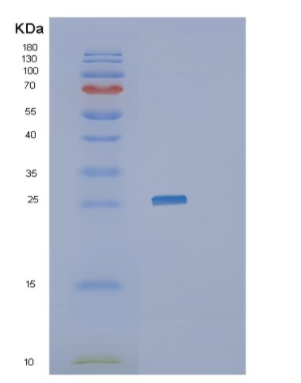 Recombinant Human JAM3 Protein,Recombinant Human JAM3 Protein