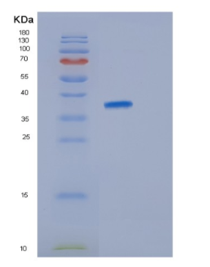 Recombinant Human JSRP1 Protein,Recombinant Human JSRP1 Protein