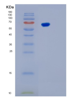 Recombinant Human KARS Protein,Recombinant Human KARS Protein