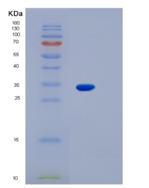 Recombinant Human KCNIP3 Protein,Recombinant Human KCNIP3 Protein