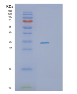 Recombinant Human ITLN1 Protein,Recombinant Human ITLN1 Protein