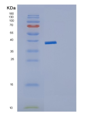 Recombinant Human JMJD7 Protein,Recombinant Human JMJD7 Protein