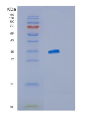 Recombinant Human ISG15 Protein,Recombinant Human ISG15 Protein