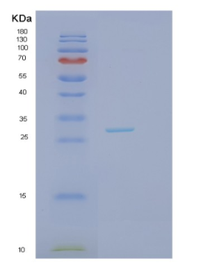 Recombinant Human JAZF1 Protein,Recombinant Human JAZF1 Protein