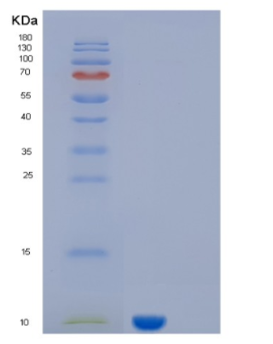 Recombinant Human KAAG1 Protein,Recombinant Human KAAG1 Protein