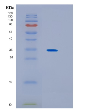 Recombinant Human KCTD4 Protein,Recombinant Human KCTD4 Protein