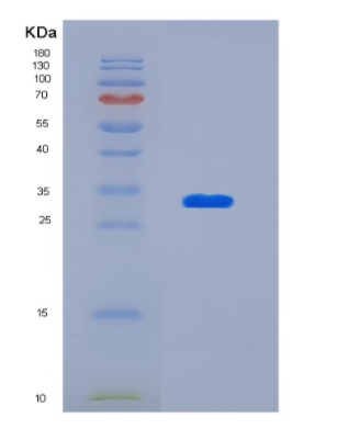 Recombinant Human Ketohexokinase Protein,Recombinant Human Ketohexokinase Protein