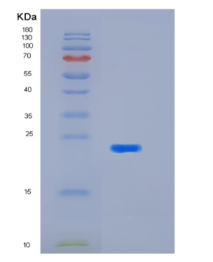 Recombinant Human KIR2DL1(p58 KIR Protein,Recombinant Human KIR2DL1(p58 KIR Protein