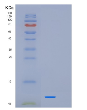 Recombinant Human KISS1 Protein,Recombinant Human KISS1 Protein