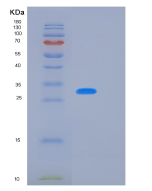 Recombinant Human KLK10 Protein,Recombinant Human KLK10 Protein