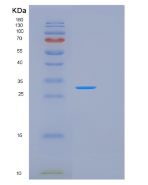 Recombinant Human KLK2 Protein,Recombinant Human KLK2 Protein