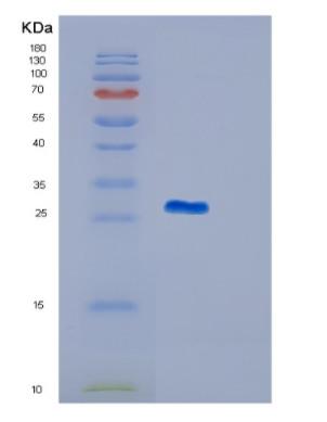 Recombinant Human ITGB1BP3 Protein,Recombinant Human ITGB1BP3 Protein