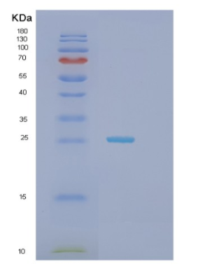 Recombinant Human JOSD1 Protein,Recombinant Human JOSD1 Protein